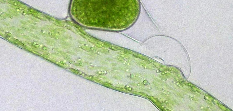 Fortpflanzung der Schlauchalge Vaucheria prolifera. (© Karl-Heinz Linne von Berg) Fortpflanzung der Schlauchalge Vaucheria prolifera. (© Karl-Heinz Linne von Berg)